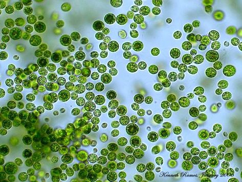 Light signals algae to stick on surfaces | Microbiology Glowing Algae, Soil Microbes, Effective Microorganisms, Soil Microorganisms, Micro Organisms, Microscopic Algae, Sea Monkeys, Linkedin Banner, Galapagos Tortoise