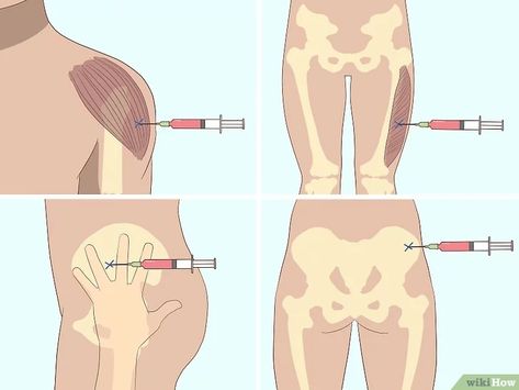 blood is aspirated, then the medication can be pus Medical Prints, Medications Nursing, Medical Assistant Student, B12 Injections, Medical School Life, Nursing School Motivation, Nursing Mnemonics, B12 Deficiency, Nursing Student Tips