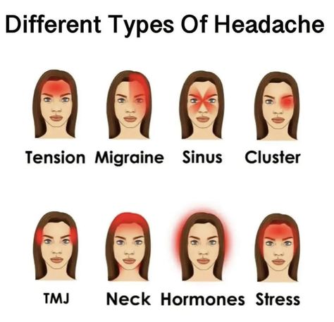 Reasons For Headaches, Types Of Headache, Birth Manga, Tension Migraine, Natural Headache, Case Presentation, Headache Types, Nursing Student Tips, Neck And Back Pain