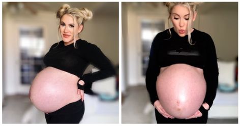 Woman pregnant with twins gets pregnant with third baby 10 days later Short Pregnant Women, Pregnant Belly Huge, Huge Pregnant, Getting Pregnant With Twins, Short Height, Pregnant With Twins, Premature Birth, Natural Pregnancy, Unborn Baby