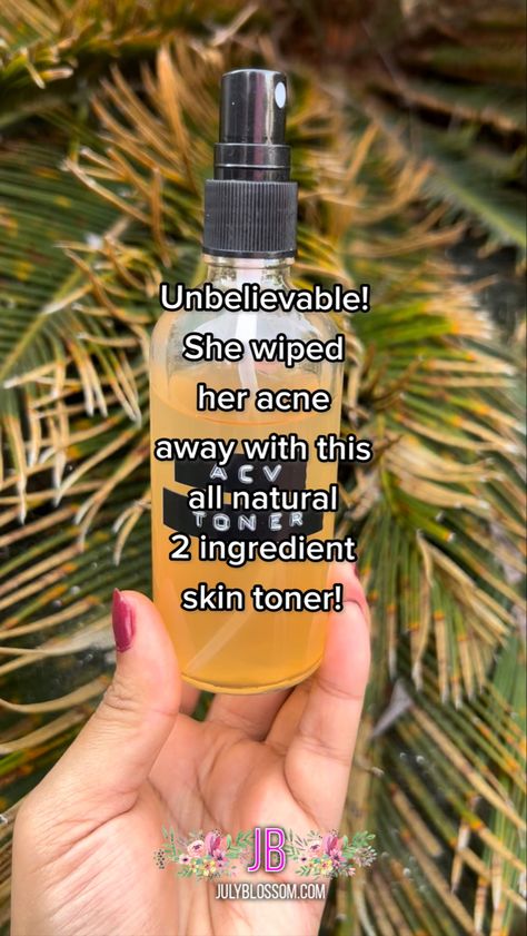 Apple Cider Face Toner, How To Use Apple Cider Vinegar For Skin, Apple Cider Vinegar Toner Recipe, Apple Cider Vinegar For Skin Care, Apple Cider Vinegar Face Wash Recipe, Apple Cider Vinegar Skin Care, Diy Face Toner For Acne, Acv Toner Diy, Apple Cider Vinegar Rinse For Hair