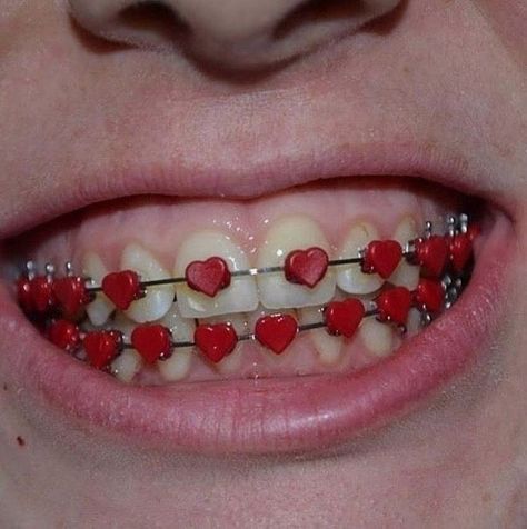 Heart Braces, Aesthetic Crazy, Cute Braces, Braces Colors, Soft Grunge Aesthetic, Flowers Real, Aesthetic Tumblr, Tumblr Aesthetic, Pinterest Photos