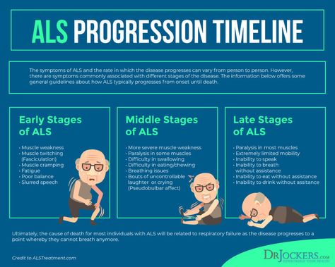 Als Disease, Als Symptoms, Brain And Spinal Cord, Lou Gehrigs Disease, Amyotrophic Lateral, Physical Therapy School, Nerve Cells, Hyperbaric Oxygen Therapy, Muscle Twitching