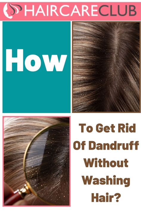 How To Get Rid Of Flakes In Hair, How To Hide Dandruff Hairstyles, Get Rid Of Dandruff Fast, Hairstyles To Hide Dandruff, How To Reduce Dandruff, Best Shampoo For Dandruff, How To Remove Dandruff, Natural Dandruff Remedy, Dandruff Solutions