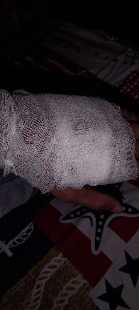 Accident Boys Dpz Hospital, Hat Kata Pic Real, Hand Damage Dpz, Hand Kata Pic Real, Injury Snapchat Streaks, Accident Hand Dpz, Accident Dp, Hat Kata Pic, Blood Photos