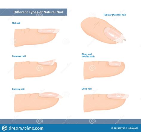 Illustration about Different Types of Fingernail. Normal, Short, Roofed, Tubular, Arched, Flat, Convex and Concave Nails. Nail Extension Guide. Vector Illustration. Illustration of anatomy, curve, growth - 202960790 Flat Nails Shape, Nail Bed Damage, Types Of Nails Shapes, Nail Theory, Long Nail Beds, Natural Nail Shapes, Nail Tech School, Nail Shapes Square, Artistic Nails