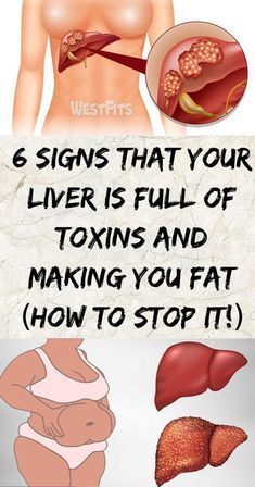 Non Alcoholic Fatty Liver Strategy is the ultimate program for detoxifying and repairing your liver in four weeks to eliminate non alcoholic fatty liver and the risks that come with it. Autogenic Training, Natural Liver Detox, Liver Detox Diet, Detox Your Liver, Cleanse Your Liver, Full Body Detox, Liver Diet, Healthy Liver, Liver Detox