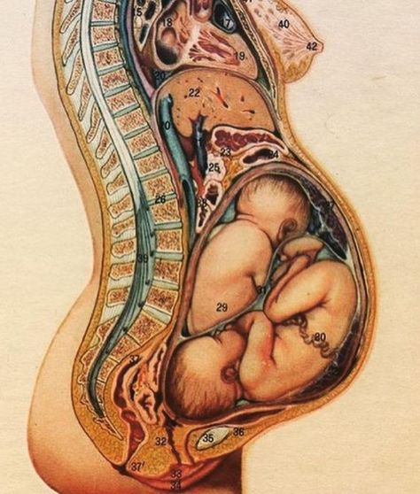 Pregnancy Anatomy, Twin Belly, Twin Pregnancy Belly, Twin Mum, 4th Trimester, Pregnancy Art, Baby Laundry, Childbirth Education, Postpartum Body