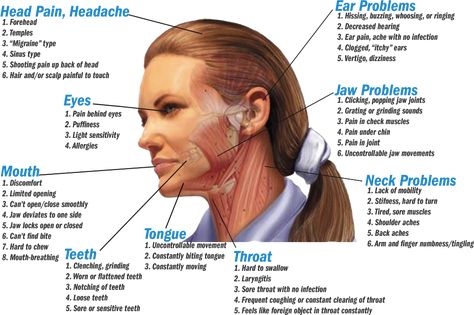 Tmj Headache, Punkty Spustowe, Tmj Relief, Ear Ache, Jaw Pain, Head Pain, Natural Teeth Whitening, Chiropractic Care, Chronic Fatigue