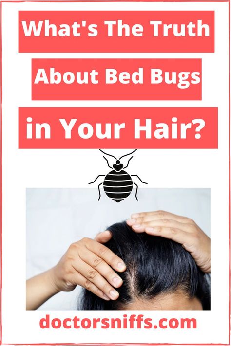 can bed bugs live in hair? Bedbugs Removal Diy, Bed Bugs How To Get Rid Of, Bed Bug Bites Pictures, Bed Bug Remedies, Bed Bugs Pictures, Signs Of Bed Bugs, Bug Bites Remedies, Get Rid Of Bed Bugs, Bed Bug Spray