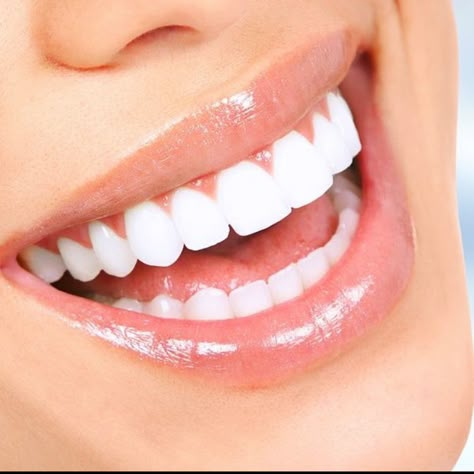 Peroxide Teeth Whitening, Teeth Aesthetic, Pretty Teeth, Teeth Pictures, Veneers Teeth, Beautiful Teeth, Teeth Whitening Gel, Straight Teeth, Perfect Teeth