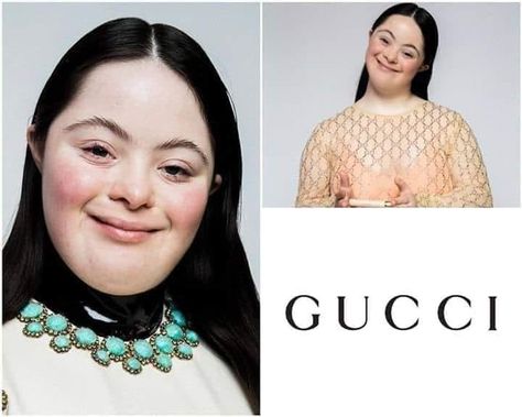 This is Ellie Goldstein, who has become the new Gucci model. First one with down syndrome.

Respect to the brand for tolerance and treating every human being equal. This is also an act of love, showing beauty in every person. ❤ Subway Baby, Show Beauty, Disabled People, Gucci Model, Influential People, Gucci Models, Skin Care Remedies, Human Being, Human Anatomy