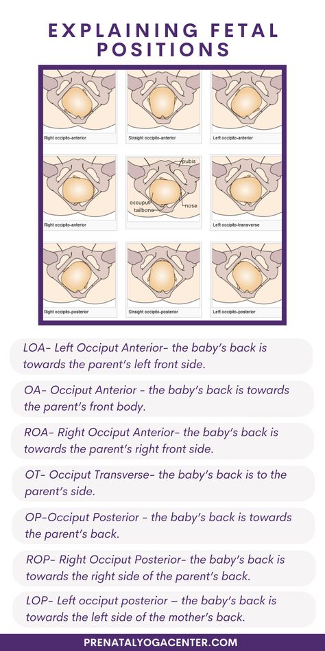 Birth Positions With Epidural, Epidural Birth Positions, Birthing Positions, Fetal Position Drawing Reference, Labor Positions With Partner, Prenatal Exercises First Trimester, Fetal Monitoring Nursing, Epidural Birth, Stages Of Fetal Development