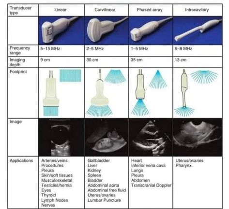 Ultrasound Tech Student, Sonography Physics, Dms Student, Sonography Student Study, Sonography Humor, Ultrasound Technician School, Diagnostic Medical Sonography Student, Ultrasound School, Ultrasound Physics