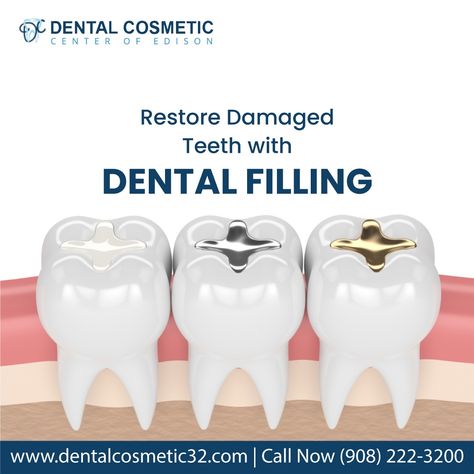 Are you looking for a way to restore your teeth to their natural beauty? Look no further than DENTAL FILLING! Our revolutionary dental cosmetic solution is designed to fill in cavities and repair damage, giving you the perfect smile. visit us at www.dentalcosmetic32.com Book an appointment (908) 222-3200 #dentalcosmetic #edison #dentalcare #smile #Plainfield #naturalbeauty #dentalcare Filling Teeth, Teeth Filling, Dental Post, Dental Advertising, Dental Decay, Dental Posts, Dental Posters, Tooth Filling, Dental Restoration