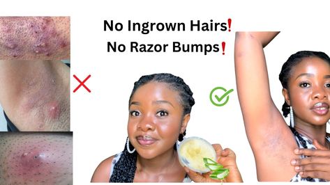 Razor bumps and ingrown hairs? No thank you! Click here to learn how to avoid them for good. Shaving Bumps, Shaving Tips, Razor Bumps, Ingrown Hairs, Shower Skin Care, Ingrown Hair, After Shave, Bump, Shaving