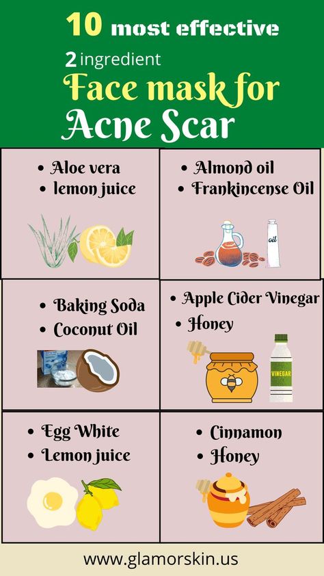 face mask for acne Pimple Scar Removal, Face Mask For Pimples, Masks For Acne, Face Mask For Acne, Acne Scar Mask, Mask For Acne, Remedies For Acne, Blind Pimple, Pimples Under The Skin