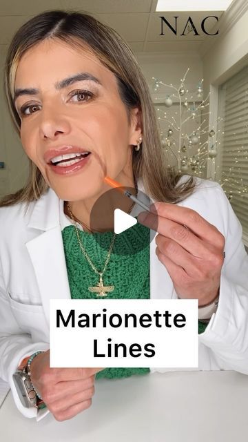 Botox Marionette Lines, Botox For Marionette Lines, Marionette Lines Before And After, Marionette Lines Filler, Jawline Filler, Botox Injection Sites, Mom Makeover, Aesthetics Business, Injection Sites