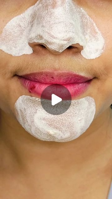 How To Remove Blackheads At Home, Black Heads Removal Homemade, Black Head Remover Diy, Blackheads Removal Homemade, Neck Pimples, Bleach Hair Dye, Tea Tree Face Wash, Lemon Mask, How To Remove Blackheads