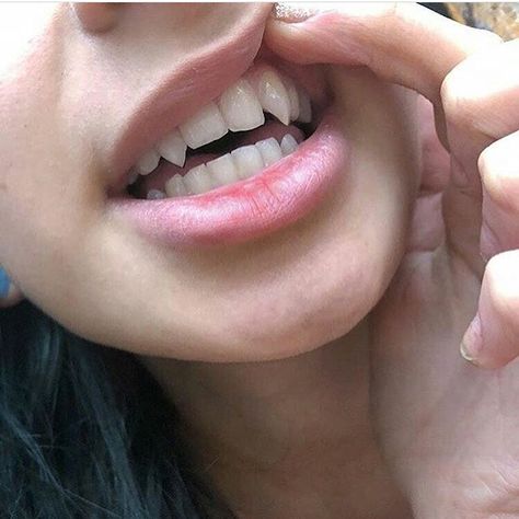 casual fangs Canine Teeth Human Aesthetic, Sharp Canine Teeth Human, Teeth Aesthetic, Fake Injury, Canine Tooth, Vampire Fangs, Vampire Teeth, Vampire Girls, Body Modifications