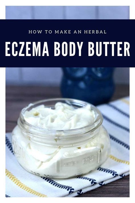 How to make a whipped body butter for eczema or dry skin. This home remedies for eczema helps relieve dry skin and moisturize with shea butter, cocoa butter, and aloe vera butter and essential… Home Made Body Butter For Dry Skin, Diy Body Butter Castor Oil, Body Butter For Excema, Diy Shea Butter Body Butter, Diy Body Butter For Dry Skin, Castor Oil Lotion Recipe, Essential Oils For Lotion, How To Make Lotion, Home Made Body Butter