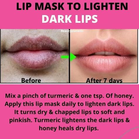 Lip Hacks, Lighten Dark Lips, Home Remedies For Warts, Natural Skin Care Remedies, Diy Skin Care Routine, Natural Face Skin Care, Dry Skin Remedies, Good Skin Tips, Perfect Skin Care Routine