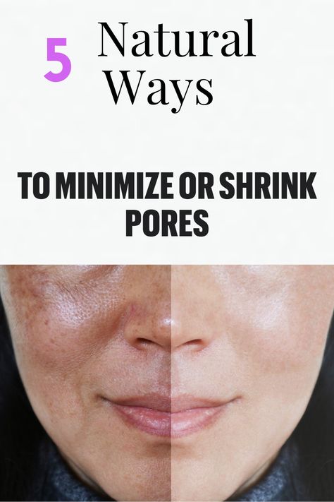 Make Pores Smaller, Big Pores, Lotion For Oily Skin, Nose Pores, Face Pores, Tips For Oily Skin, Oily Skin Acne, Anti Wrinkle Skin Care, Eye Skin Care