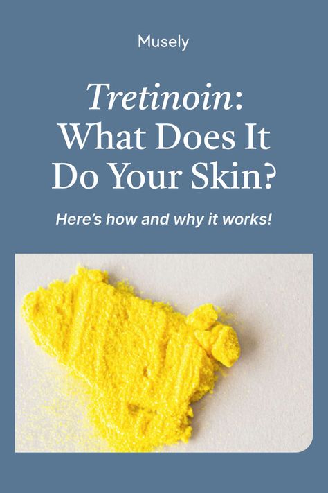 Learn the science of tretinoin, a powerful anti-aging skincare ingredient ✨ Tretinoin speeds up the skin cell turnover process to effectively treat wrinkles, fine lines, dark spots, acne, and more. It’s also 20 TIMES more effective than over-the-counter retinol while gentle on the skin! #skincare #antiaging Tretinoin Before And After, Retin A, Chemical Elements, Retinoic Acid, Prevent Aging, Clear Complexion, Skincare Ingredients, Aging Skin Care, Retinol