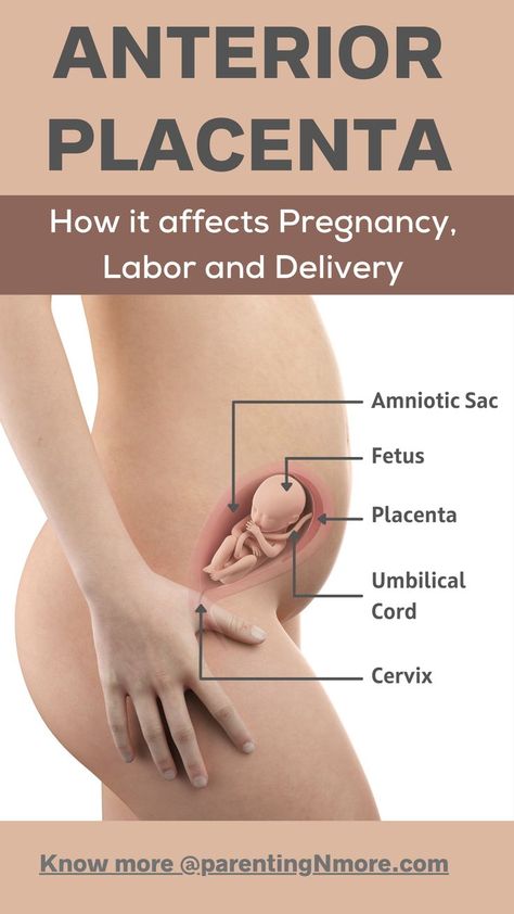 Having an Anterior Placenta or placenta in front is something you need not worry about. Understand all about this placenta position and how it affects various aspects of your pregnancy and anterior placenta risks, so that you are well prepared for whatever lies ahead #placentapsotion #pregnancy Anterior Placenta, Human Body Vocabulary, Pregnancy Labor, Human Body Systems, Labor And Delivery, Reproductive System, Medical Knowledge, Body Systems, Medical Education