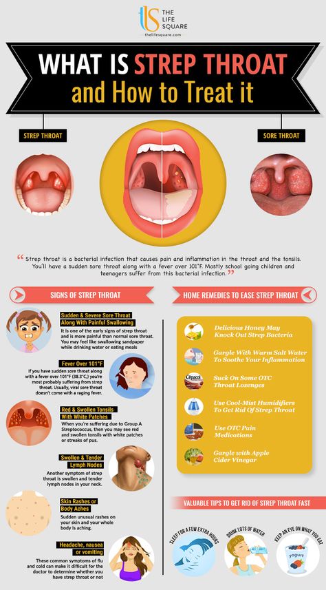 Warning Signs Of Strep Throat Signs Of Strep Throat, Sore Throat Remedies For Adults, Strep Throat Remedies, Throat Remedies, Sore Throat Remedies, Dry Cough Remedies, Throat Pain, Throat Infection, Sick Remedies