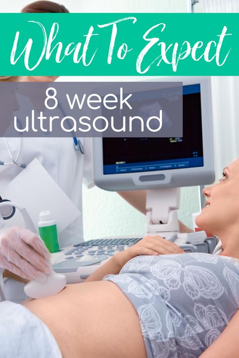 Wondering what to expect at your 8 week ultrasound appointment? First of all, congrats mama on your pregnancy, yay! Now that the news have set it or not, still surprised? It’s time for your first prenatal visit! What to expect at your 8 week ultrasound appointment? A lot of exciting things.  Many doctors like to schedule your first prenatal appointment at your 8 week mark. This is because a fetus and heartbeat is usually confirmed and visible at this point. Ultrasound Appointment Outfit, Prenatal Appointment Schedule, Pregnancy 8 Weeks, 8 Weeks Pregnant Ultrasound, 9 Week Ultrasound, 10 Week Ultrasound, 8 Week Ultrasound, 8 Weeks Pregnant, First Prenatal Visit