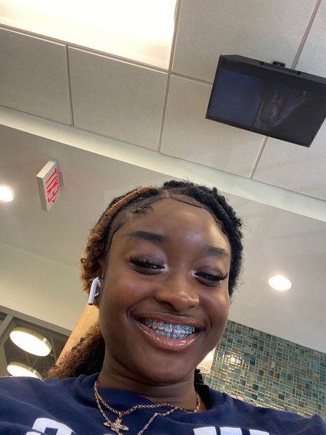 Braces Colors For Black Women, Blue Braces Aesthetic, Blue Braces Colors, Braces For Dark Skin, Braces Color For Dark Skin, Silver Braces Black Women, Teeth Manifestation, Braces Colors Black Women, Braces Colors Ideas Brown Skin