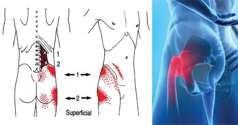 The 8 BEST Stretches To Loosen Tight Hips And Hamstrings (They Also Ease Low Back Pain) Back Spasm, Psoas Release, Hip Flexor Exercises, Back Stretches For Pain, Hip Flexor Stretch, Tight Hip Flexors, Improve Your Posture, Psoas Muscle, Hip Stretches