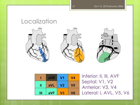 Acute Coronary Syndrome, School Notes, Thing 1 Thing 2, Nursing, For Free, Education, Comics