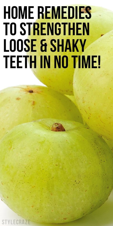 Loose Teeth, Teeth Nails, Teeth Remedies, Mouth Care, Tooth Care, Teeth Whitening Remedies, Strengthen Teeth, Loose Tooth, Teeth Health