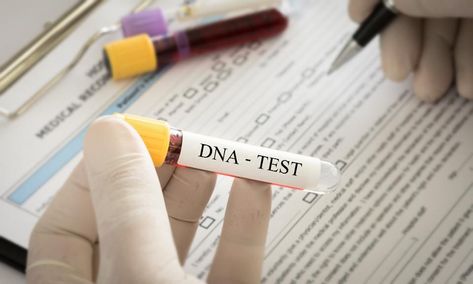 NY Times, Why Are You So Worried About 23andMe's Genetic Tests? FORBES 2/4/19 Home Safety Tips, Dna Test Results, Cholesterol Test, Genealogy Websites, Dna Results, Cholesterol Remedies, Cholesterol Lowering Foods, Lower Your Cholesterol, Cholesterol Diet