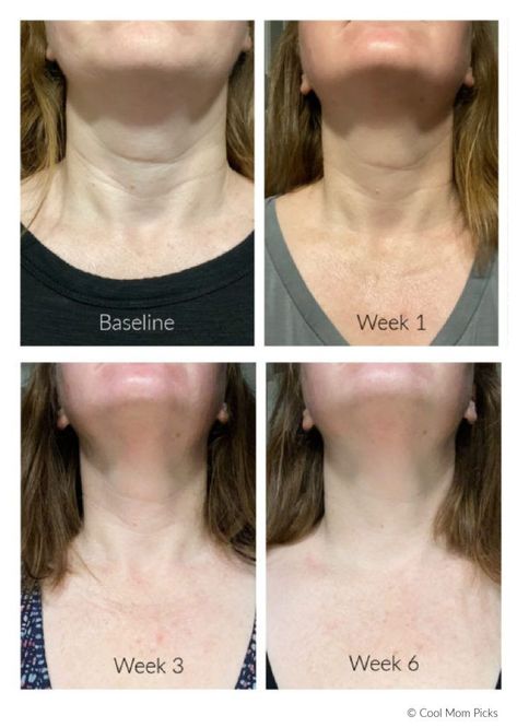 Trying DefenAge 6 Week Neck Perfecting Cream: Before and after photos. Whoa | Full review: Cool Mom Picks | beauty tips | skin care products | moisturizer | skin cream | new beauty products | beauty hacks | #defenage #beautytips #skincare How To Firm Neck Skin, Best Firming Face Cream Skin Tightening, Neck Cream Firming Best, Neck Tightening Cream, Facial Remedies, Neck Firming Cream, Best Neck Cream, Perfect Neck, Tighten Facial Skin