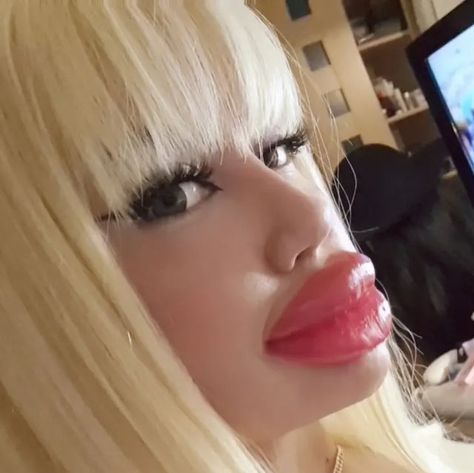 Big Lips Funny, Bratz Lips, Fake Lips, Plump Lips, Love Lips, Botox Fillers, Lip Fillers, Permed Hairstyles, March 1