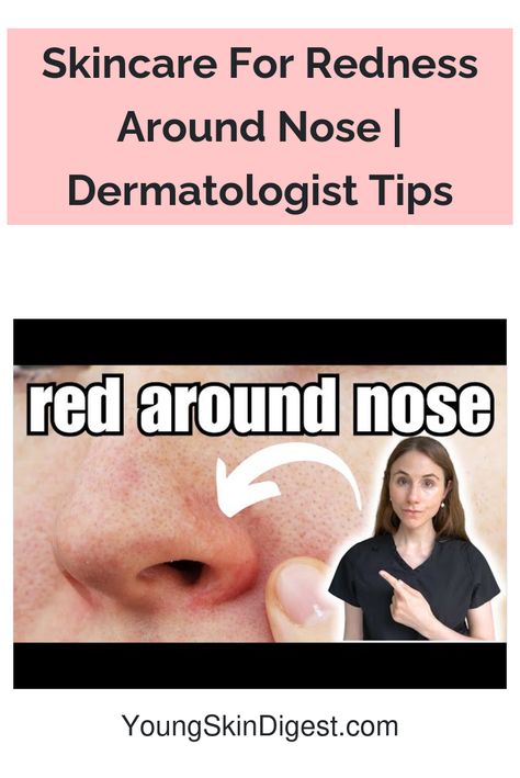 Skincare For Redness Around Nose | Dermatologist Tips Nose Care Routine, Get Rid Of Facial Redness, How To Get Rid Of Redness Around Nose, Get Rid Of Redness On Face, How To Reduce Redness On Face, Sores Inside Nose, How To Get Rid Of Redness On Face, Dry Skin Around Nose, Acne Around Nose