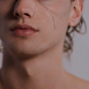 Lucien Vanserra, Frost And Starlight, Eye Scar, Lightning Scar, Facial Scars, Court Of Mist And Fury, Luke Castellan, Silver Flames, Rid Of Blackheads