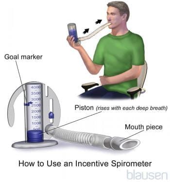 Chest Physical Therapy - Lung and Airway Disorders - Merck Manuals Consumer Version Incentive Spirometer, Types Of Surgery, Chronic Obstructive Pulmonary Disease, Medical Products, Muscle Weakness, Pulmonary Disease, Exercise Routines, Deep Breathing Exercises, Lung Disease