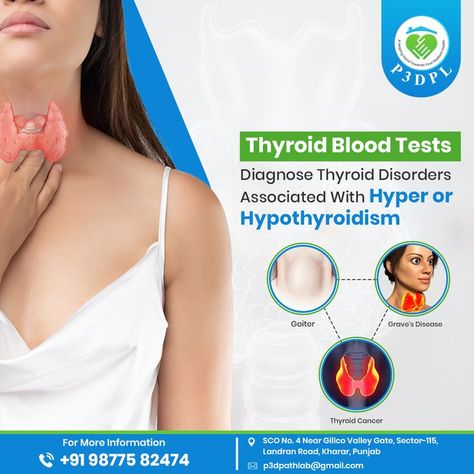 Thyroid Blood Tests Thyroid Vitamins, Pull Up Banner Design, Pull Up Banner, 3d Ultrasound, Thyroid Test, Pathology Lab, Health Poster, Graves Disease, Thyroid Hormone