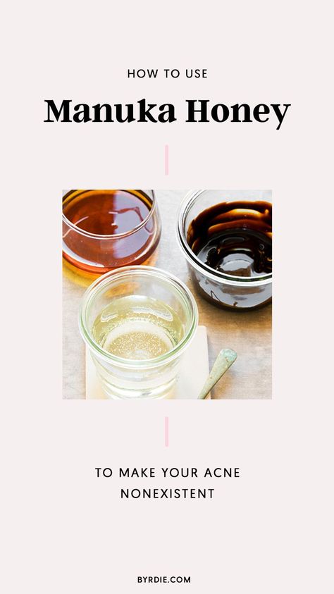 How to use manuka honey on acne-prone skin Clear Pimples, Honey For Acne, Acne Home Remedies, Skin Care For Acne, Korean Skin Care Products, Skin Care Routine For 20s, Get Rid Of Acne, Rid Of Acne, Skin Cleanser