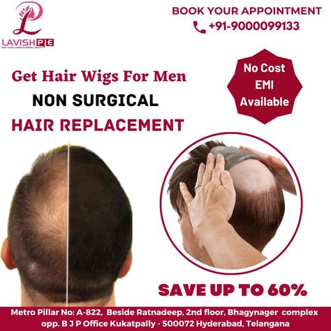 Hair Replacement For Men, Wigs For Men, Hair Wigs For Men, Regrow Hair, Bald Heads, Hair Solutions, Hair Replacement, Hair Wigs, Wig Hairstyles