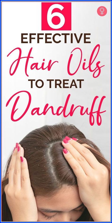 Bonus Tip: Use a dry shampoo to refresh your hair between washes. #hairgrowthremedies #hair #hairfall Dandruff Products, Treat Dandruff, Dandruff Solutions, Home Remedies For Dandruff, Oils For Dandruff, Dandruff Hair, Dandruff Remedy, Hair Oils, Best Hair Care Products