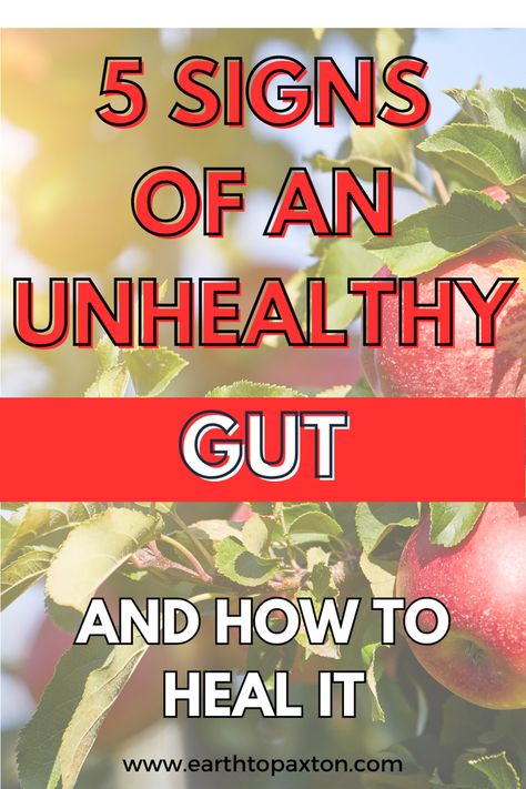 Foods to Heal Leaky Gut | Gut Health Diet | Leaky Gut Symptoms Natural Remedies |   Gut Healing Diet | Leaky Gut Remedies Foods To Help Heal Your Gut, How To Naturally Heal Your Gut, Gut Health Remedies, Healing Gut Foods, Best Diet For Gut Health, Healing Gut Inflammation, What Is A Leaky Gut, Better Gut Health Diet, Acv For Gut Health