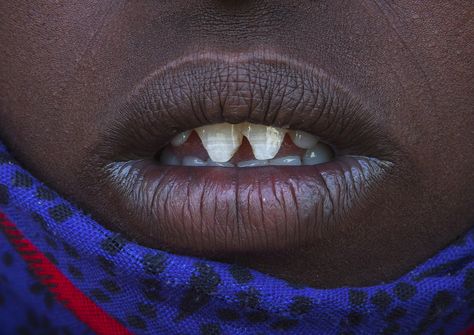 Afar Tribe Woman With Sharpened Teeth, Assaita, Afar Regional State, Ethiopia | © Eric Lafforgue www.ericlafforgue.com Afar Tribe, Sharpened Teeth, Afar People, Egyptian People, African Pots, Black Teeth, 2024 Images, Eric Lafforgue, Horn Of Africa