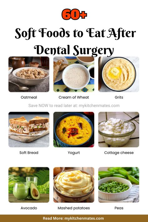 Soft Food Ideas After Dental Work Food After Dental Surgery, What To Eat After Wisdom Teeth Removal, Soft Soups After Dental Surgery, Post Wisdom Teeth Food, Soft Dinner Ideas, Wisdom Teeth Recovery Tips, Soft Foods After Surgery Teeth, Soft Food Ideas, Wisdom Teeth Removal Recovery