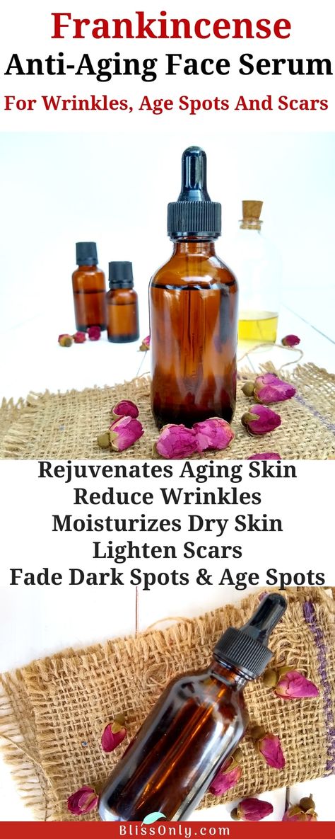 Frankincense Anti Aging, Face Serum Recipe, Serum Recipe, Lighten Scars, Lotion For Oily Skin, Skin Care Routine For 20s, Anti Aging Face Serum, Creme Anti Age, Inner Forearm