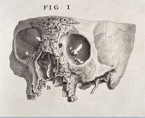 19th-Century Illustrations Medicine Images, Francis Picabia, Samuel Beckett, Medical Art, Dorian Gray, Human Skull, Scientific Illustration, Anatomy Drawing, Medical Illustration